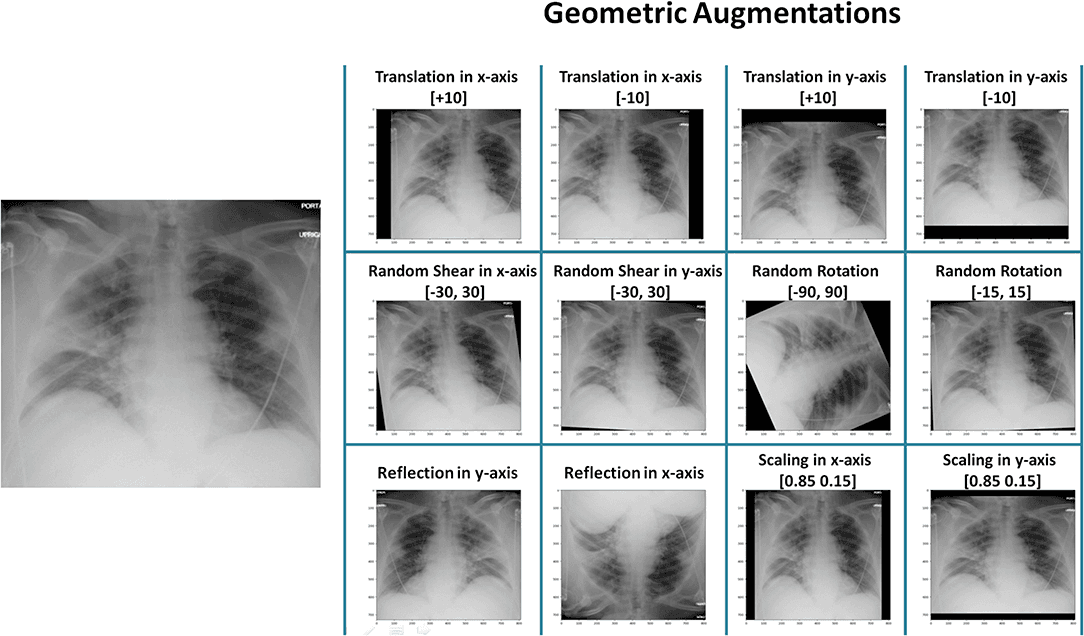 Geometric Augmentations on Xray images of the heart